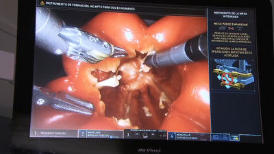 Operar con el robot Da Vinci en la Semana de la Ciencia