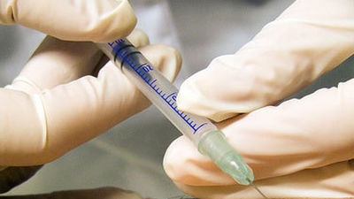 Detenida una falsa médica que hacía tratamientos de belleza en Madrid