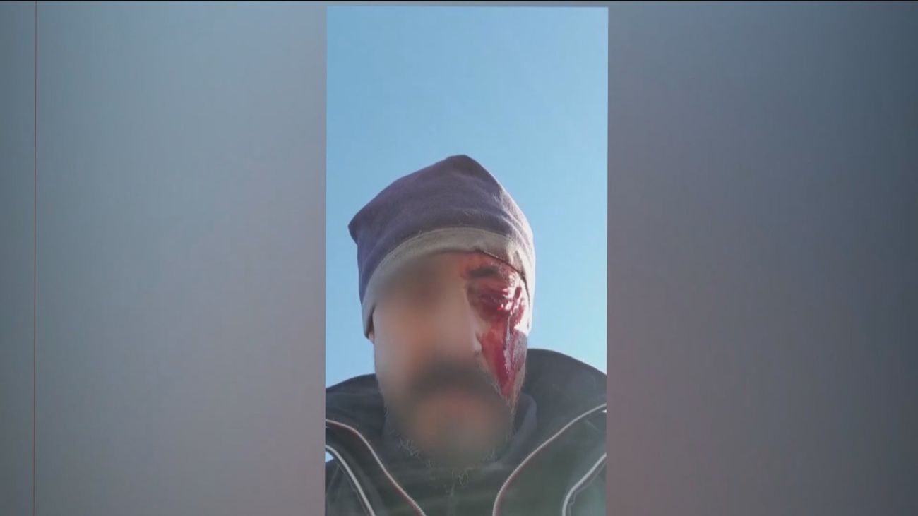 Dos cazadores detenidos tras una pelea con dos vecinos de Casarrubios del Monte