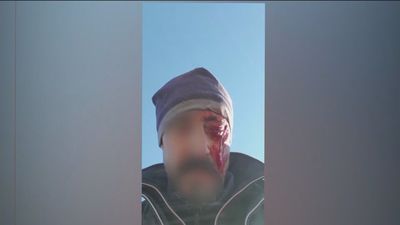 Dos cazadores detenidos tras una pelea con dos vecinos de Casarrubios del Monte