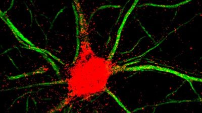 Descubren una forma de activar las células madre del cerebro adulto