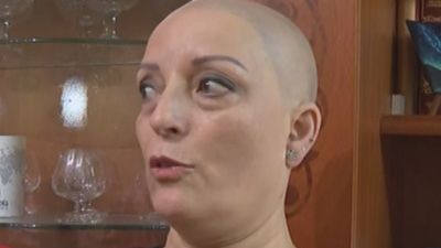 La Asociación Madrileña de Alopecia lucha contra el estigma de ser calva