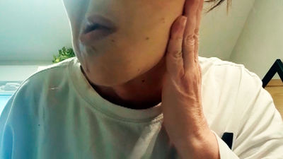 Retoques estéticos antes de la retirada definitiva de las mascarillas