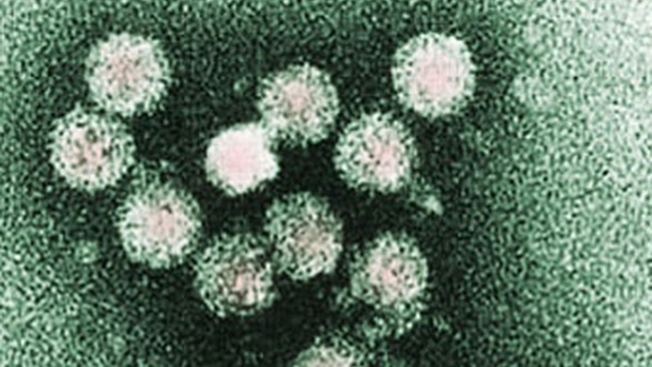 Virus de la hepatitis