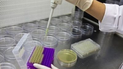 Un ensayo clínico con inmunoterapia logra eliminar el cáncer de recto en todos sus pacientes