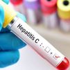 Alcorcón hará test rápidos para detectar la hepatitis C entre la población vulnerable