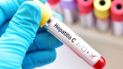 Alcorcón hará test rápidos para detectar la hepatitis C entre la población vulnerable