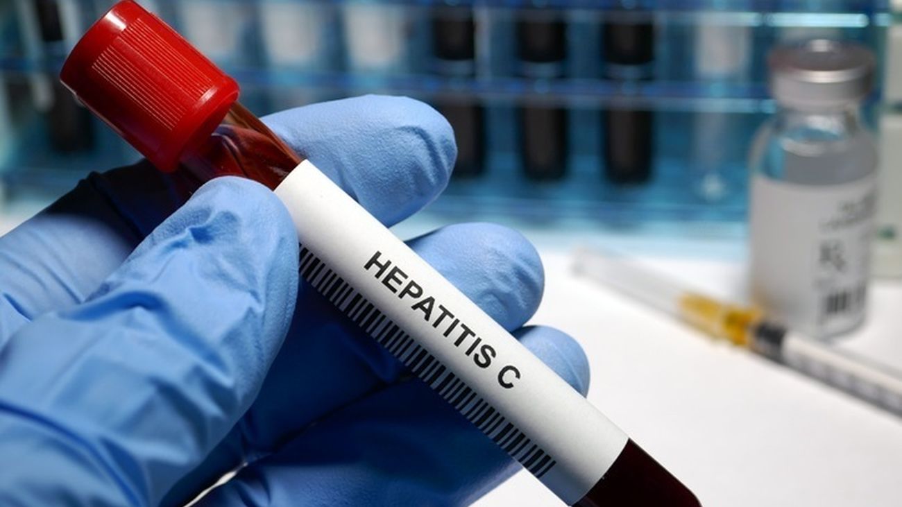 Muestra de sangre con hepatitis C