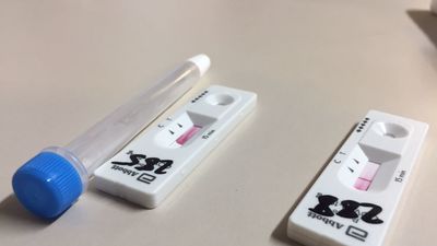 Desarrollan un test de orina que detecta la Covid