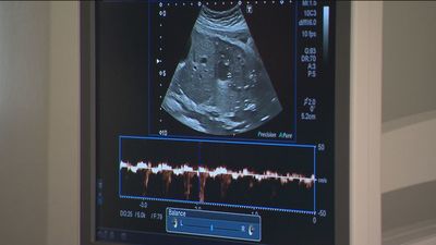 Rotunda oposición a la futura ley del Aborto por parte de PP, Vox y Ciudadanos