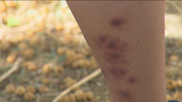 Mordeduras de mosca negra a un vecino de Madrid