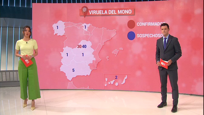 Madrid estudia si hay vínculo entre casos de viruela de la capital y Canarias