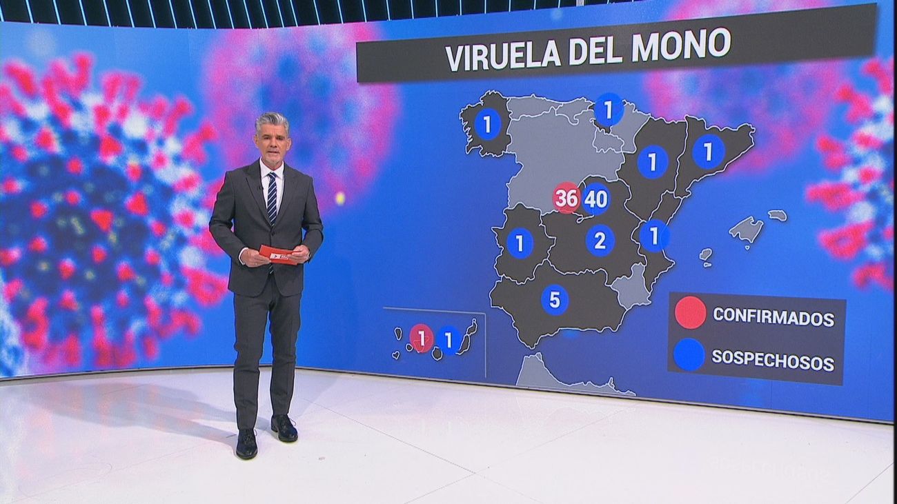 Ya hay más de 50 casos de viruela del mono en España entre confirmados y sospechosos