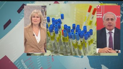 Ruiz Escudero sobre la viruela del mono: "Hay preocupación porque hay contagios multifocales"