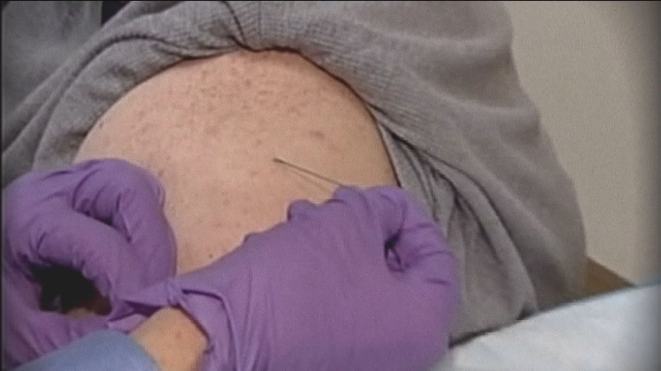 ¿Estás vacunado de la viruela? Esto es lo que debes saber sobre el virus del mono