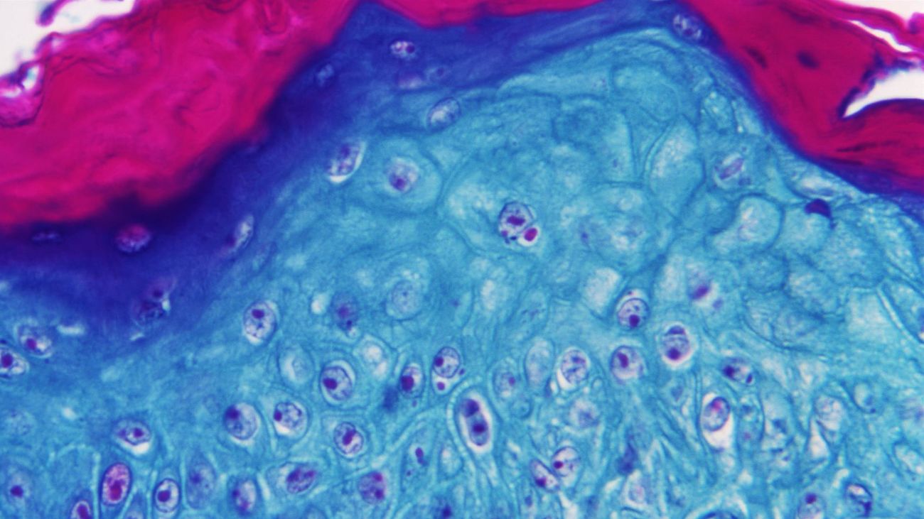 Madrid comenzará a hacer pruebas de la viruela del mono en cinco hospitales