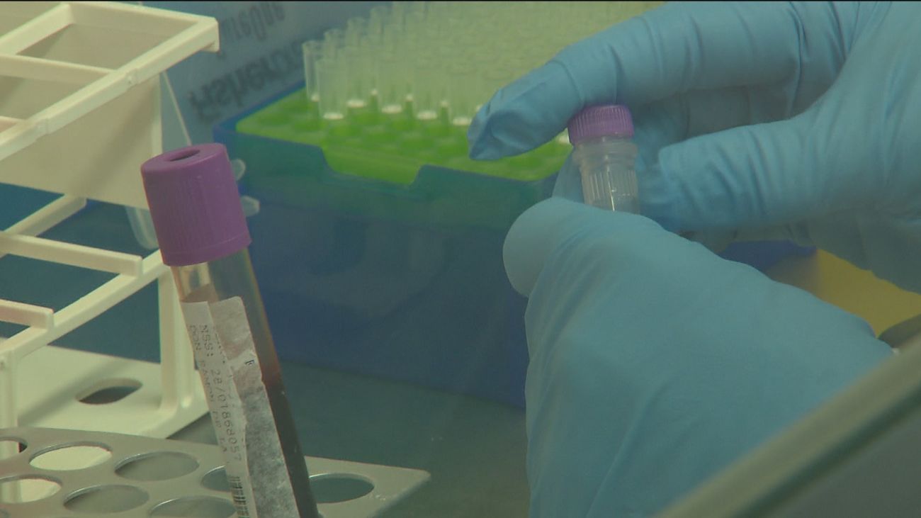 Los casos de viruela del mono en Madrid ascienden a 65