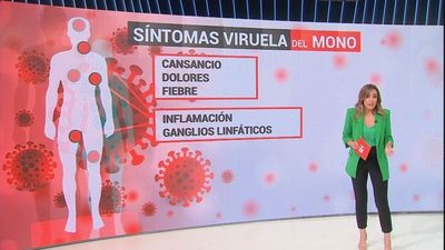 El síntoma clave que te ayuda a detectar si tienes viruela del mono