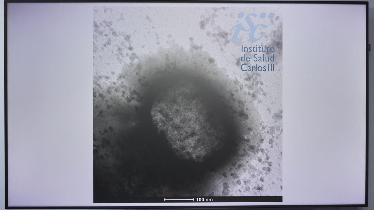 Mapa del virus del mono en España: nueve comunidades con casos confirmados y sospechosos