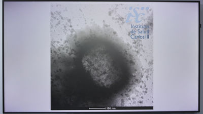 Mapa del virus del mono en España: nueve comunidades con casos confirmados y sospechosos