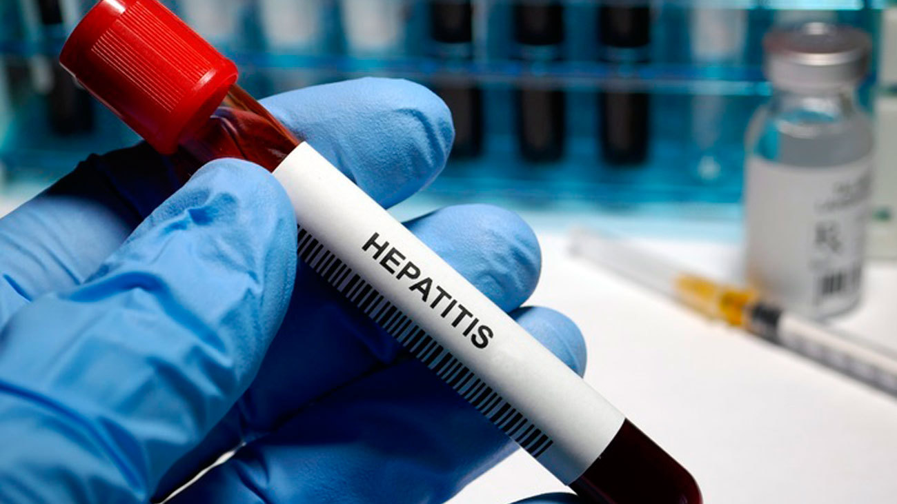 Muestra de hepatitis