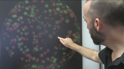 La OMS cree que la viruela del mono circuló algún tiempo sin ser detectada