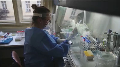 75 casos de viruela del mono en Madrid y otros 46 sospechosos