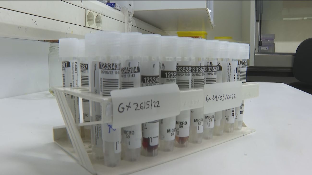 Madrid comienza a realizar las pruebas PCR y secuenciación genómica  de la viruela del mono