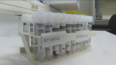 Madrid comienza a realizar las pruebas PCR y secuenciación genómica  de la viruela del mono