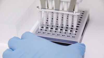 Sanidad confirma 142 casos positivos de viruela del mono en España