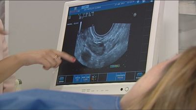 La naprotecnología: un método de conseguir el embarazo sin manipular embriones