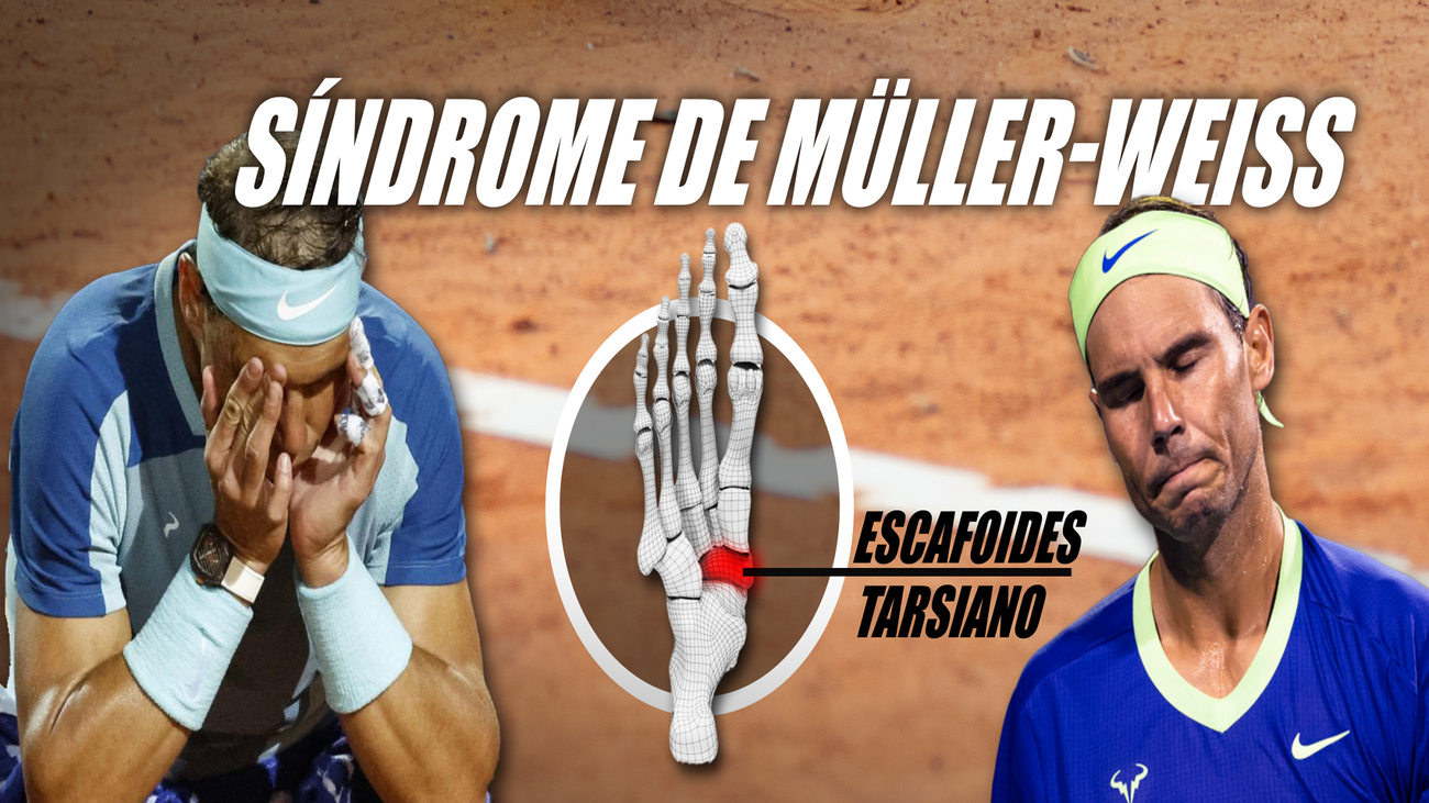 El futuro de Nadal, en el aire