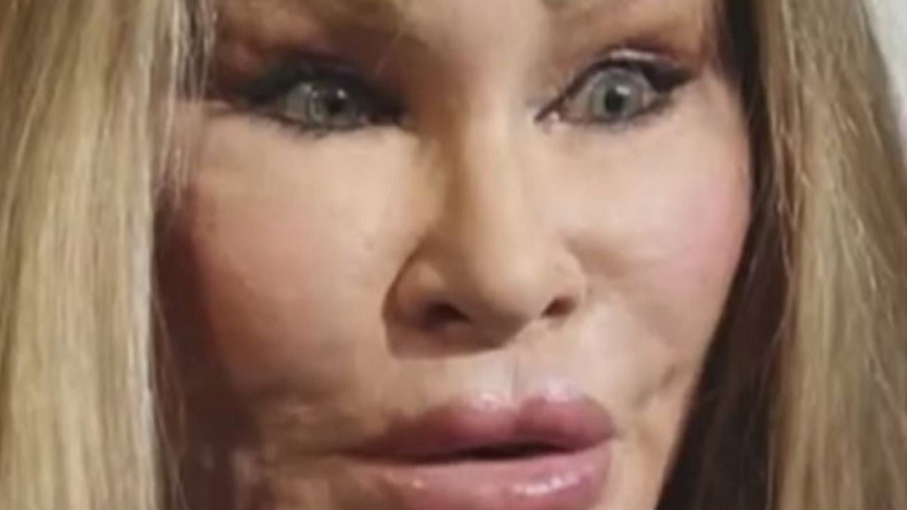 Cuando una operación de estética te puede costar la vida