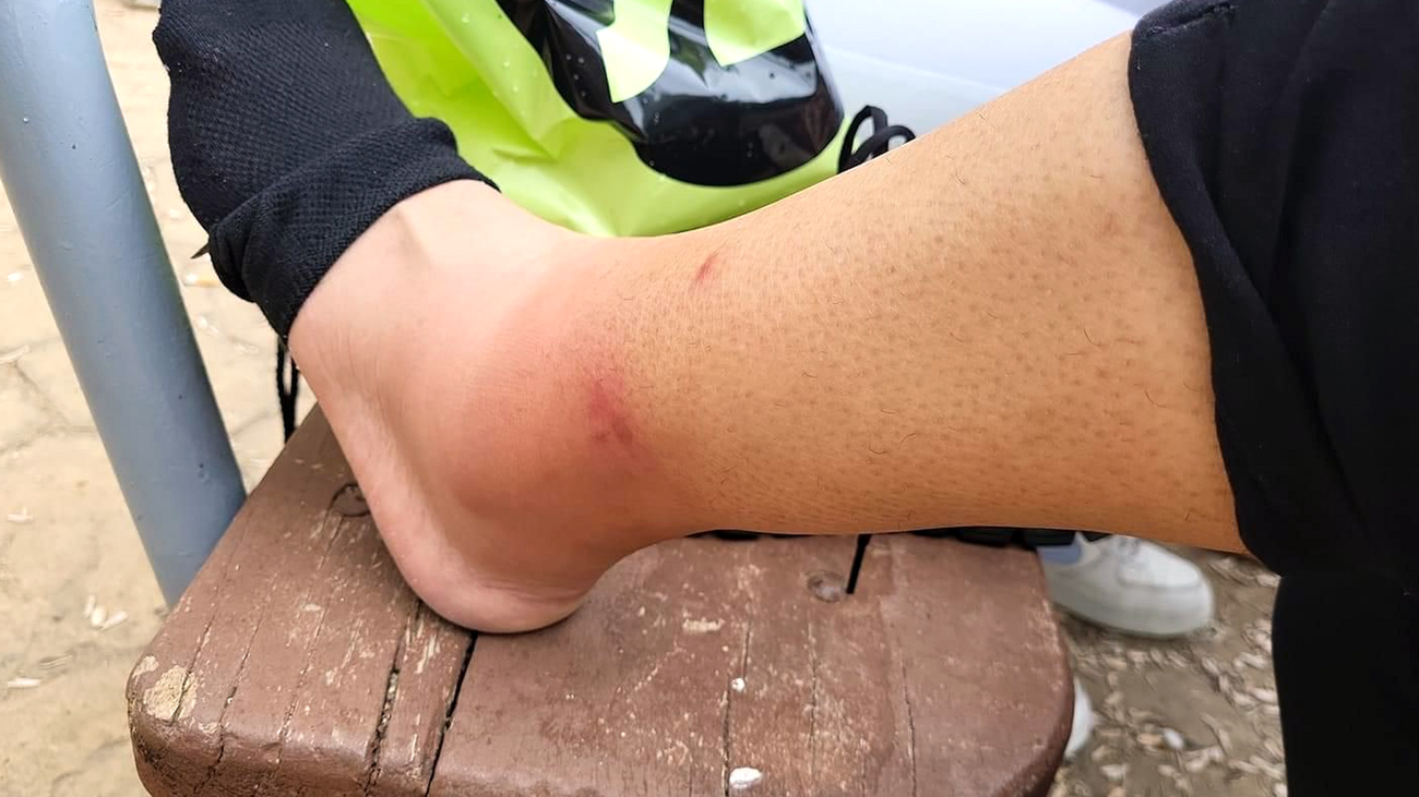 Los mosquitos se ceban con los vecinos de Torrejón de Ardoz