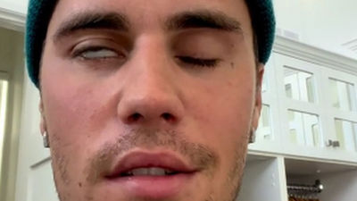 Justin Bieber sufre una parálisis facial parcial y aplaza sus conciertos