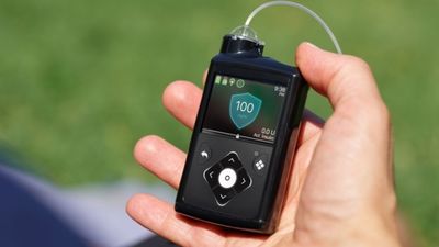 Sanidad alerta del mal funcionamiento de las bombas de insulina que usan los pacientes de diabetes