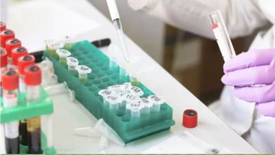 La Comunidad de Madrid supera los 500 casos de viruela del mono, con 67 nuevos positivos