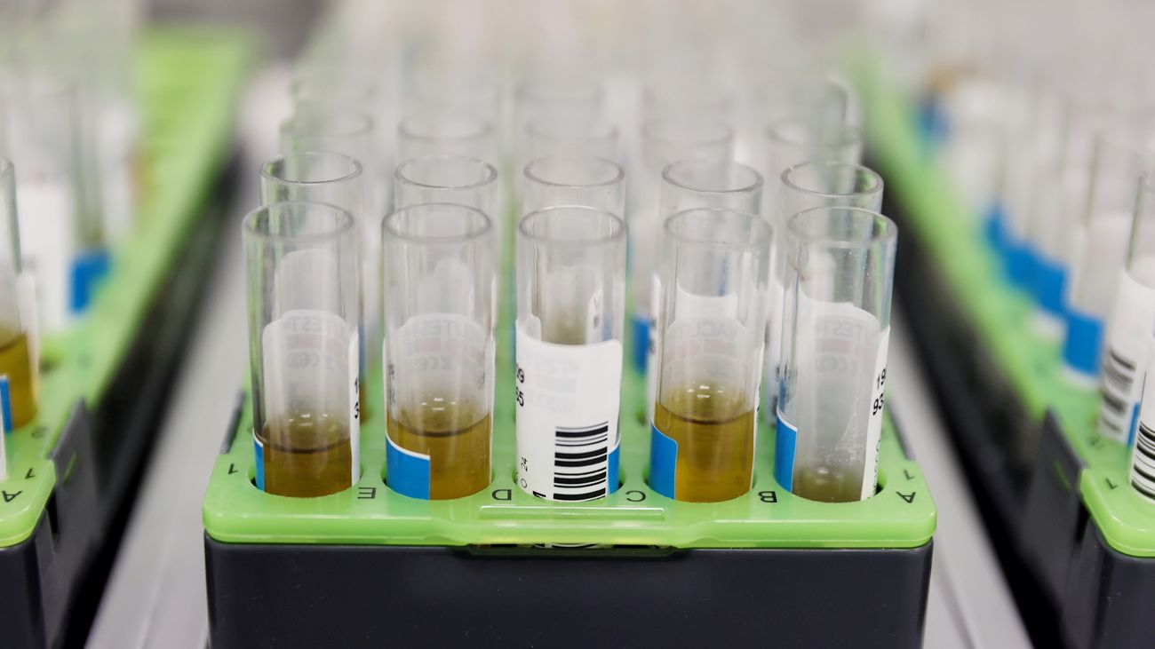 Los casos de viruela del mono ascienden a 671 en Madrid