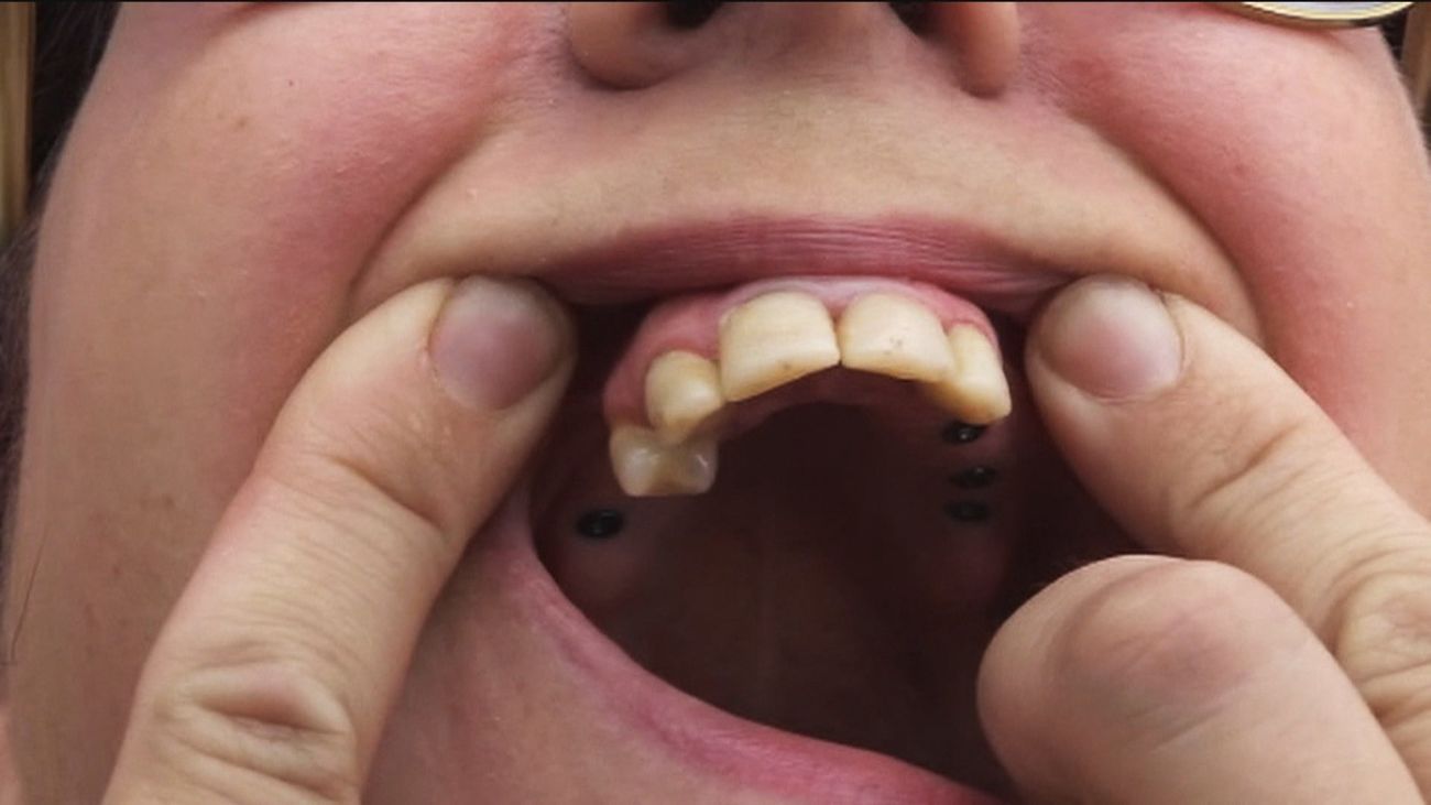 Más de 400.000 personas afectadas por iDental