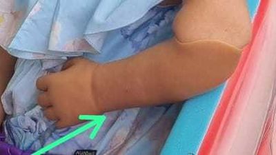 La alegría de Jimena, de 4 años, tras recuperar su prótesis perdida en Aluche