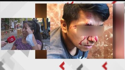 Un vecino de Aluche herido tras enfrentarse a dos ladrones que habían entrado en su casa