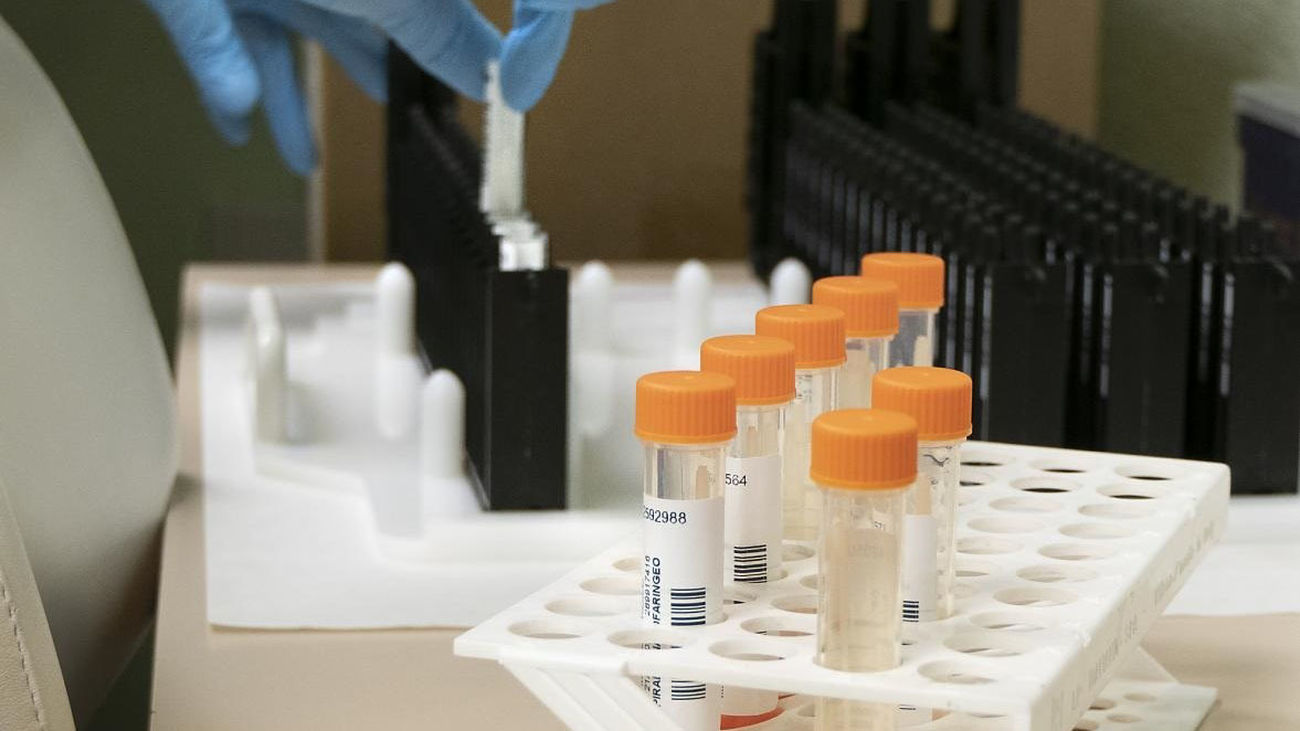 Casos de viruela del mono