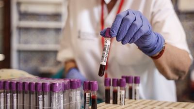 El grupo sanguíneo que hace que puedas tener menos riesgo de ingresar en UCI por Covid