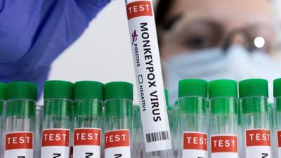 ¿Cómo prevenir y controlar la viruela del mono? 8 consejos básicos para evitar contagiarse