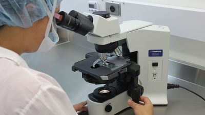 La viruela del mono podría transmitirse por aerosoles