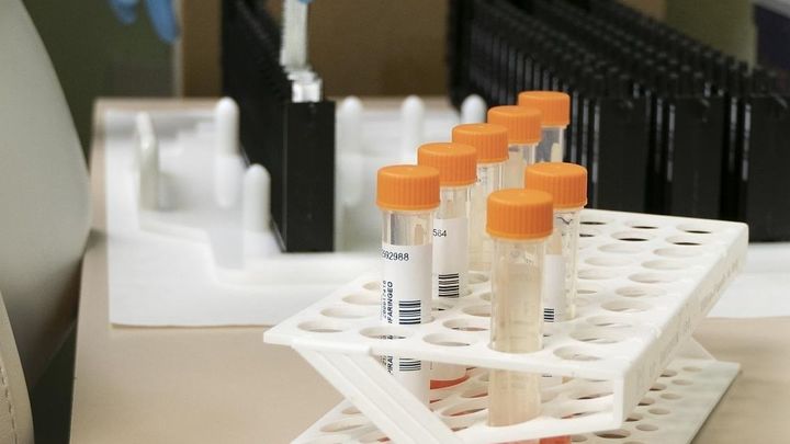 La OMS no ve necesaria la vacunación masiva contra la viruela del mono