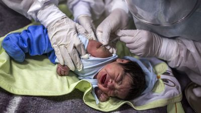 El ECDC dice que los casos de hepatitis aguda infantil son bajos y estables