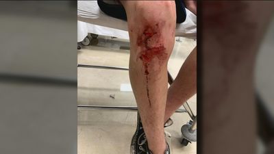 Un menor de 15 años recibe una brutal paliza al intentar proteger a su hermana en Torrelodones