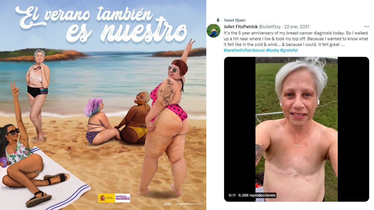 Una mujer con doble masectomía, otra de las 'víctimas' del cartel de Igualdad del verano