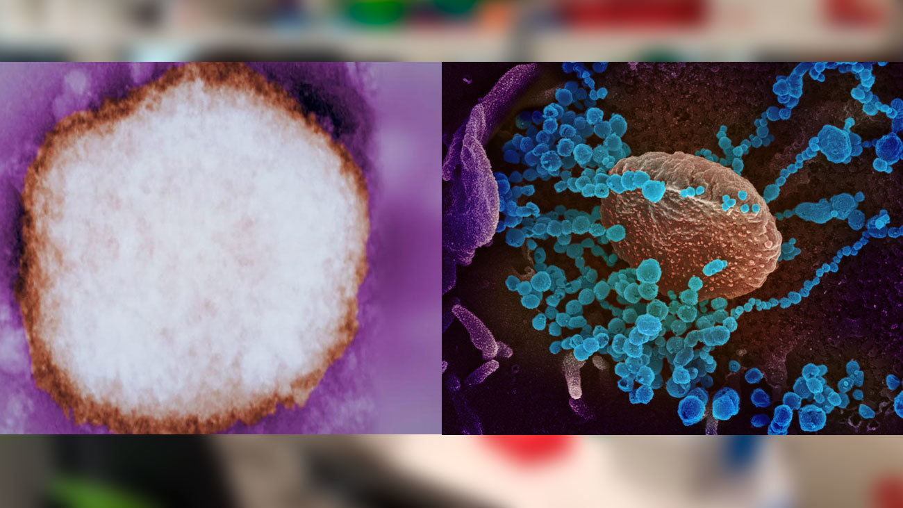 A la izquierda, el virus de la viruela del mono y a la derecha, la de SARS-CoV-2